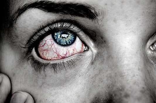 Resources That'll Make You Better at Eye Pain